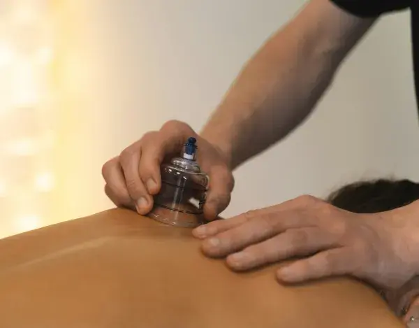 Cupping Therapy